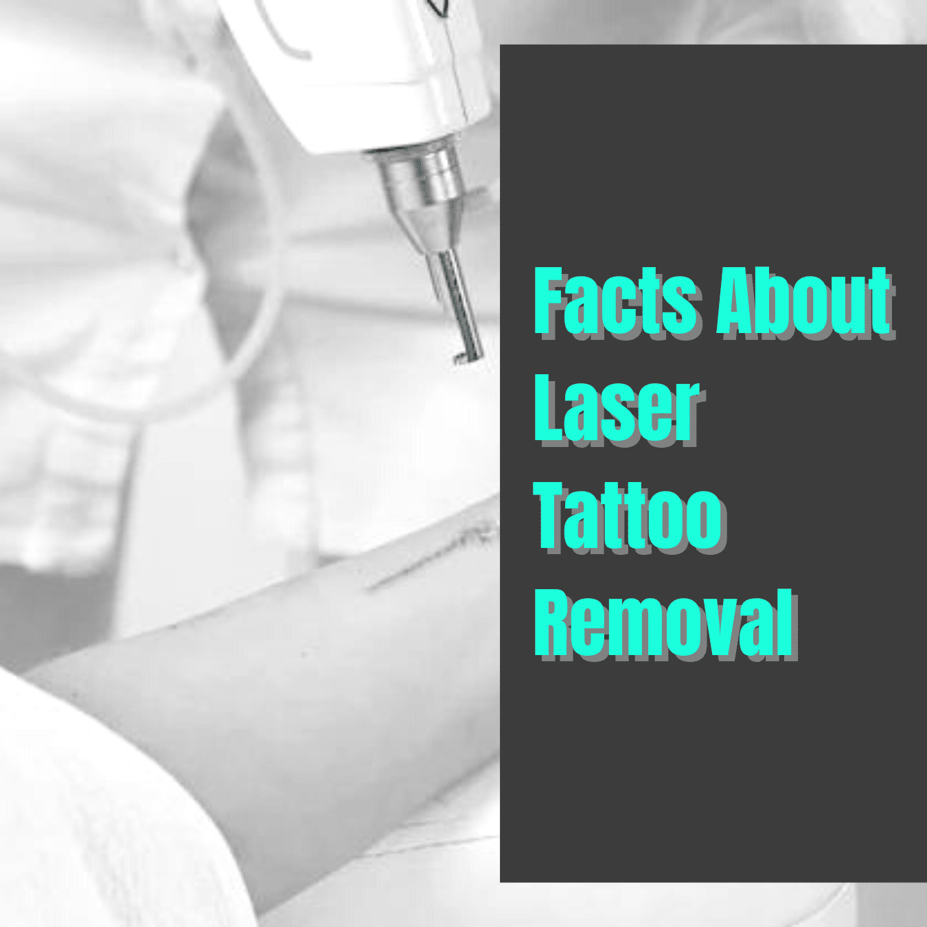 Facts about laser tattoo removal